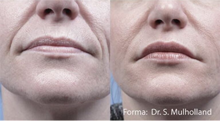 forma rf