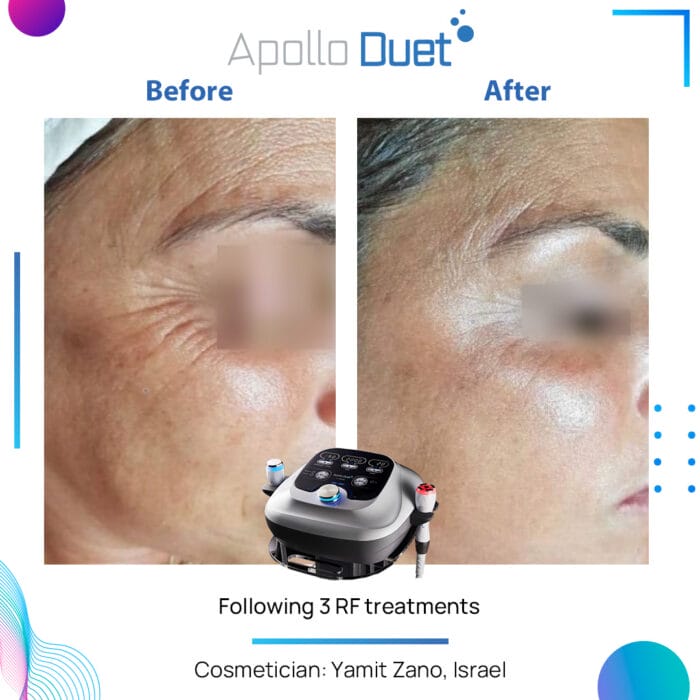 guide to anti-ageing