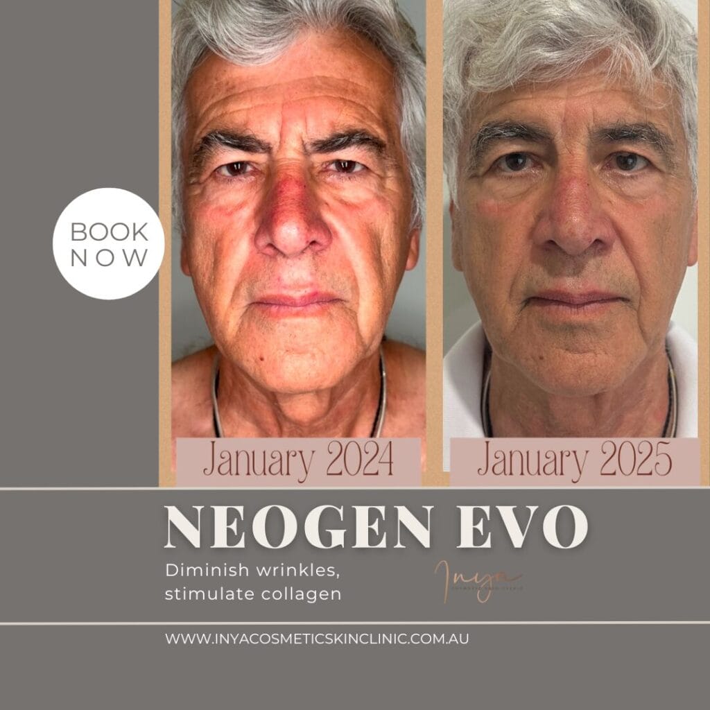 NeoGen